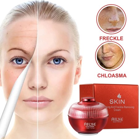 Ailke skin whitening and freckle removing-20g