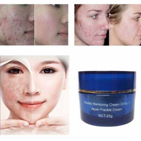 Original Japan Anti Freckle Cream-25g