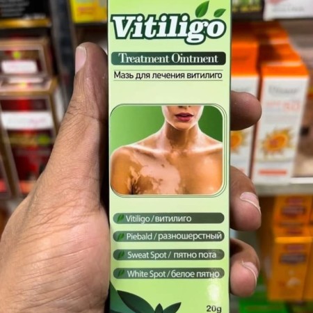 Sumifun Vitiligo Treatment Ointment 20g